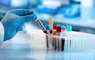 Hypertonie trifft Hypercholesterinämie – Therapietreue verbessern mit innovativer Fixkombination