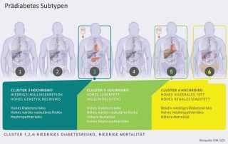 Subtypen bei Vorstufe des Diabetes entdeckt