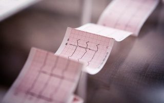 Vericiguat von Bayer erhält positive CHMP-Empfehlung zur Behandlung von Patienten mit symptomatischer chronischer Herzinsuffizienz