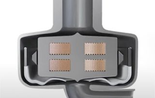 Die Vergangenheit und die Zukunft der dauerhaften mechanischen Kreislaufunterstützung
