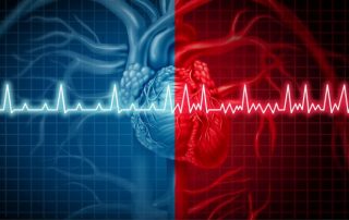 Katheterablation von Vorhofflimmern 2022: Welche Technologien gibt es? Katheterablation von Vorhofflimmern 2022: Welche Technologien gibt es?