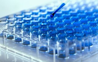 SIRION Biotech: Entwicklung neuer AAV-Vektoren für die Gentherapie von Typ-1- und Typ-2-Diabetes SIRION Biotech: Entwicklung neuer AAV-Vektoren für die Gentherapie von Typ-1- und Typ-2-Diabetes