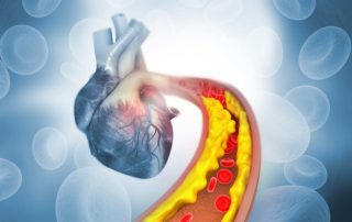 SIS Medical AG erhält die FDA-Zulassung für ihr Kernprodukt, den OPN NC® TWIN-Wall Hochdruck-Ballonkatheter, in den USA SIS Medical AG erhält die FDA-Zulassung für ihr Kernprodukt, den OPN NC® TWIN-Wall Hochdruck-Ballonkatheter, in den USA
