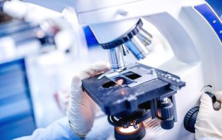 Atherosklerose: Wie erkrankte Blutgefäße mit dem Gehirn kommunizieren Atherosklerose: Wie erkrankte Blutgefäße mit dem Gehirn kommunizieren