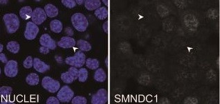 SMNDC1-Verlust lässt Alpha-Zellen Insulin produzieren