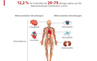 Metaanalyse: Senkt körperliche Aktivität bei Diabetes das Risiko für diabetesbedingte Komplikationen?