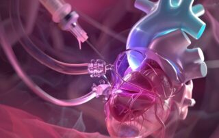 Katheterablation bei Vorhofflimmern: Welche Energieform für welchen Patienten? Katheterablation bei Vorhofflimmern: Welche Energieform für welchen Patienten?