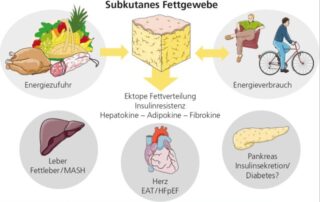 Diabetes und kardiovaskuläre Erkrankung aus der Sicht des Diabetologen Diabetes und kardiovaskuläre Erkrankung aus der Sicht des Diabetologen