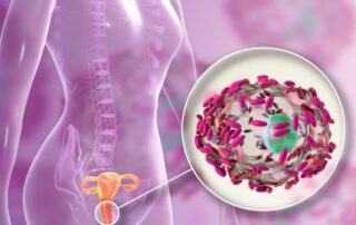 Bakterielle Vaginose: Aktuelles zu Leitlinie und Beratung Bakterielle Vaginose: Aktuelles zu Leitlinie und Beratung
