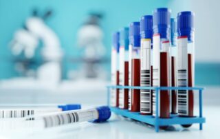 Biomarker können frühzeitig Hinweise auf erhöhtes Risiko kardiovaskulärer Erkrankungen geben Biomarker können frühzeitig Hinweise auf erhöhtes Risiko kardiovaskulärer Erkrankungen geben