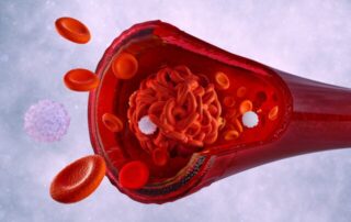 Tragbarer Venen-Checker: KI hilft bei Früherkennung von Thrombose Tragbarer Venen-Checker: KI hilft bei Früherkennung von Thrombose