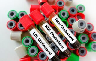 Hohe HDL-Cholesterin-Werte — immer eine gute kardiovaskuläre Prognose? Saiful52 - stock.adobe.com