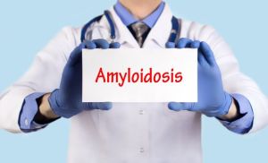 Transthyretin-Amyloidose mit Kardiomyopathie: aktuelle Diagnostik- und Therapieoptionen