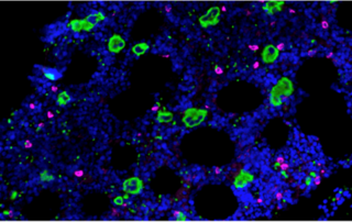 Megakaryozyten stehen unter Aufsicht von Immunzellen Megakaryozyten (grün) und plasmazytoide dendritische Zellen (magenta) im menschlichen Knochenmark, Quelle: Hellen Ishikawa-Ankerhold